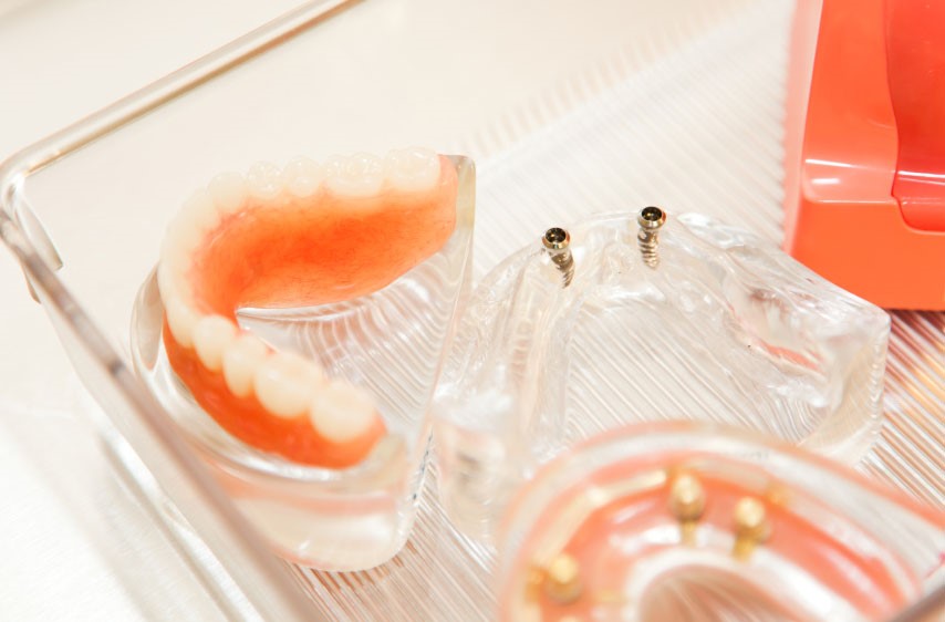 Types Of Dentures Flinton PA 16640